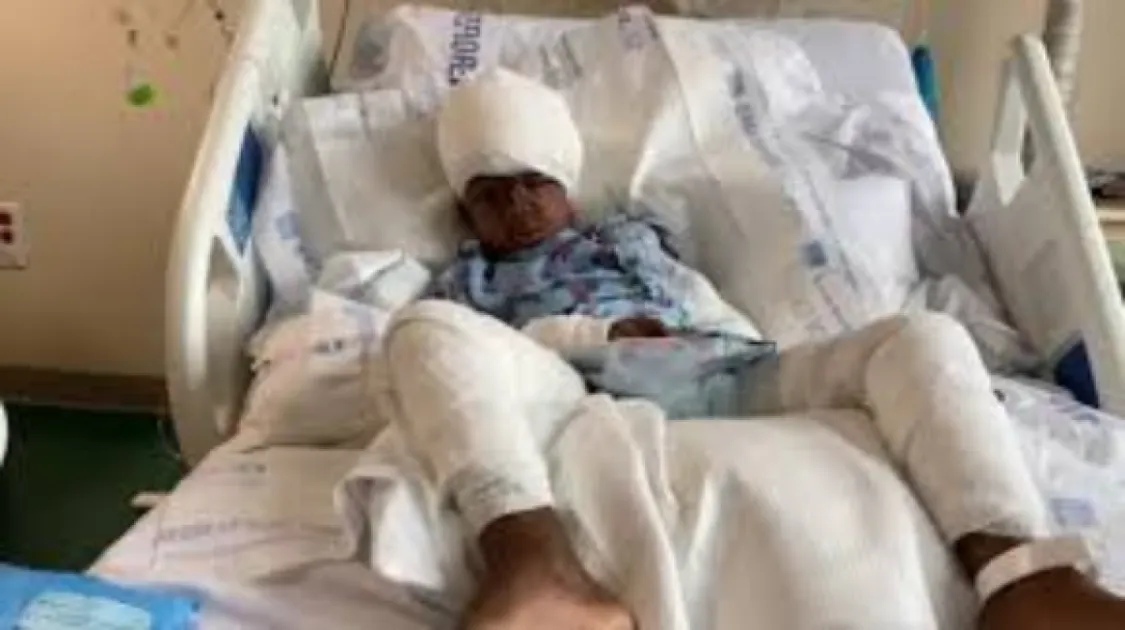 5-year-old boy mauled by dogs undergoes surgery - Writeups 24 ...